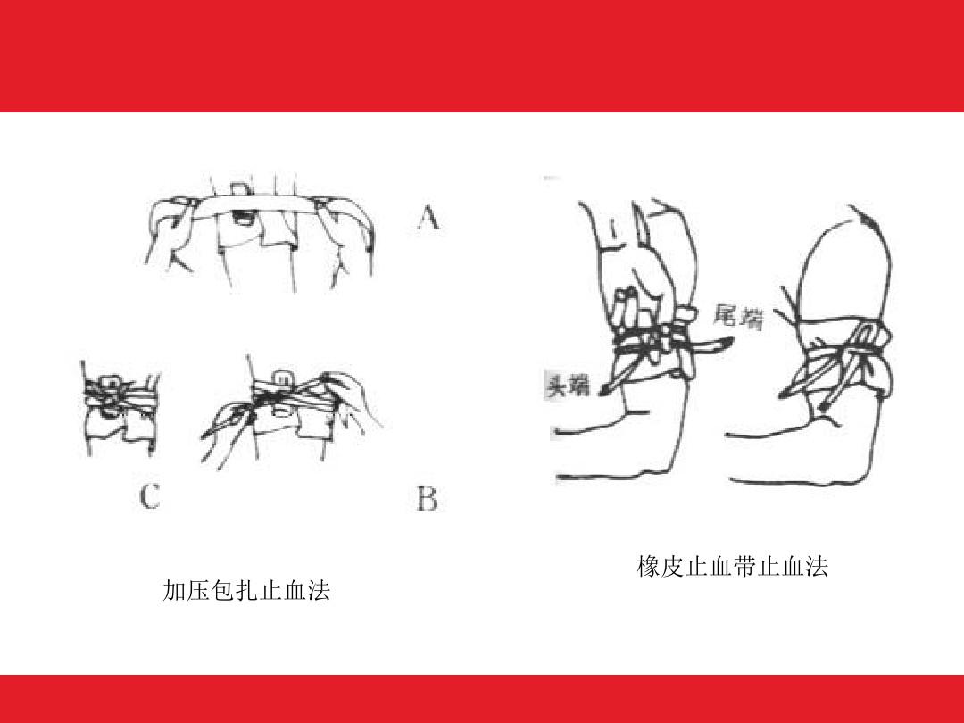 止血带使用时间过长，身体后果大