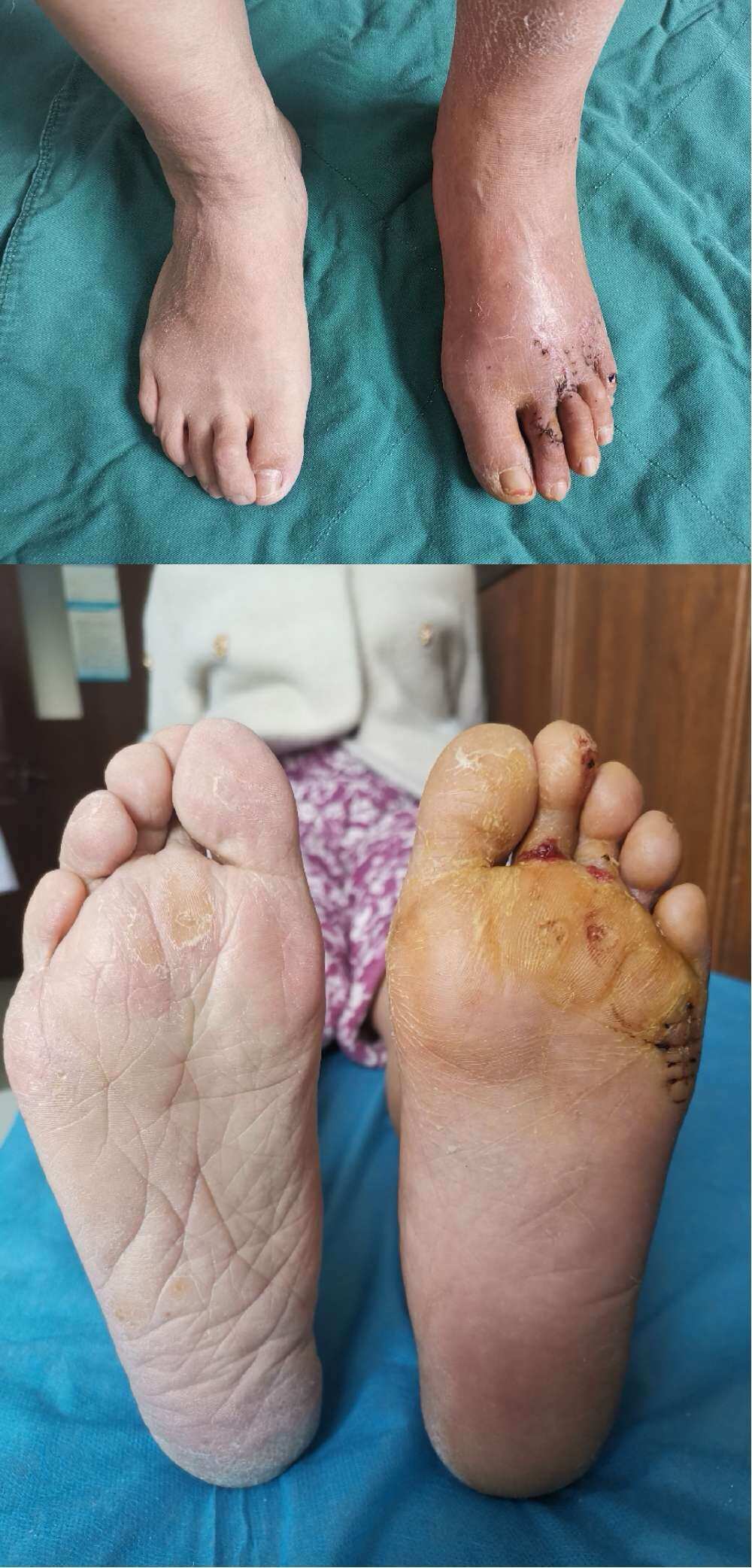 手机征途怎么加召唤天系技能点_手游征途召唤怎么加属性点_征途召唤后期厉害么