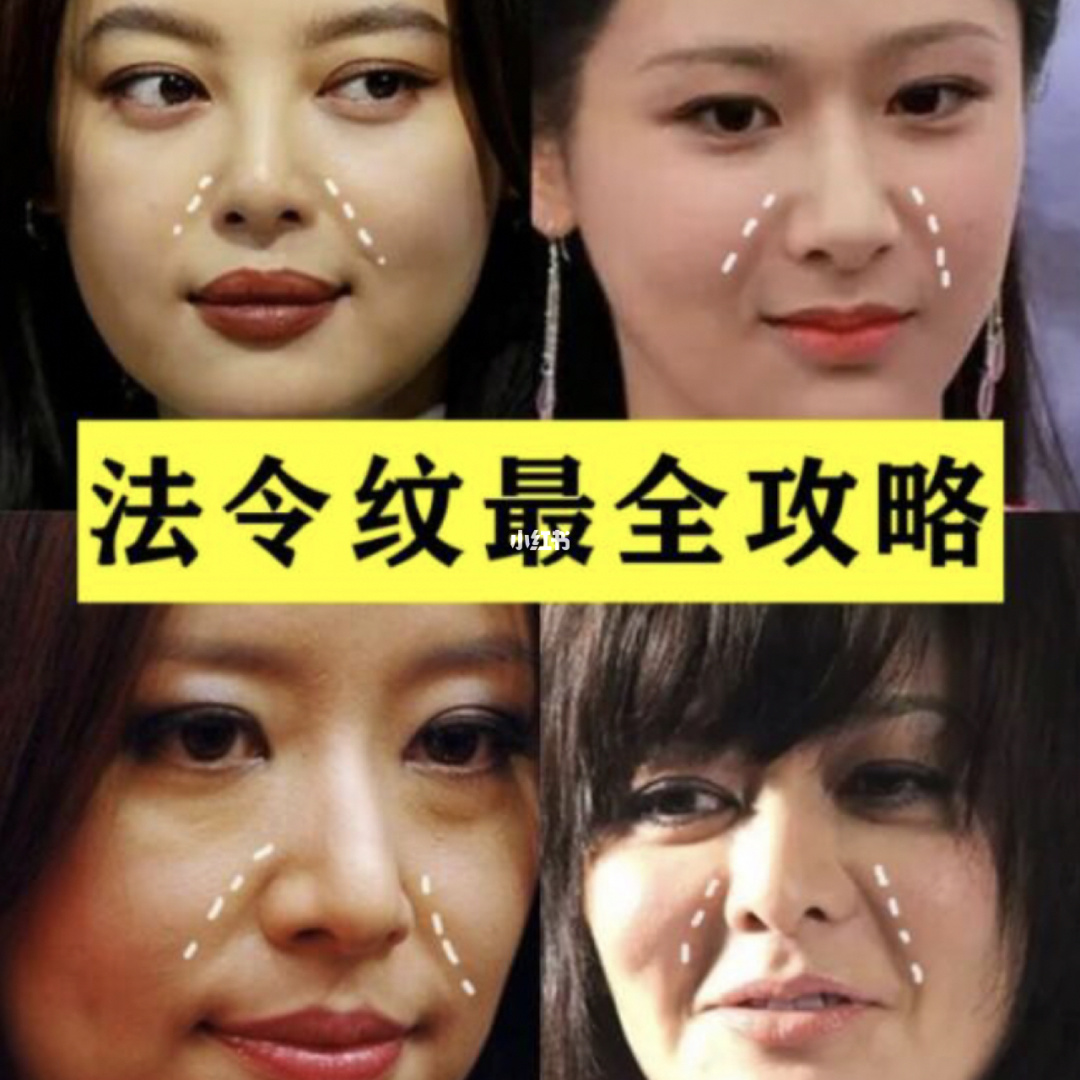 打法令纹后要注意事项_禾虫养殖需要注意哪些事项_纹唇后注意什么
