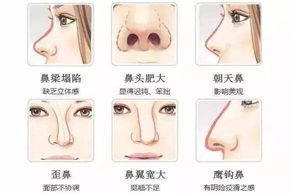 鼻子鼻梁低显得鼻子大怎么办_完美人生系统 大鼻子阿杰_若风鼻子大下面也大