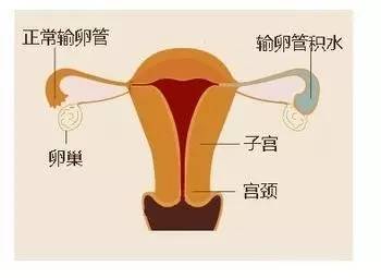 女性生殖一线图片大全_一线线图库一线彩图资料大全_一线的图片